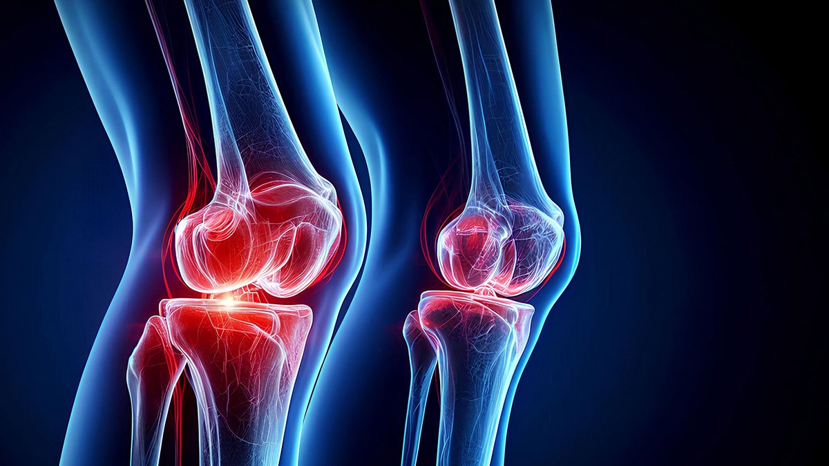 Medizinische Illustration von zwei Knien mit rot markierten Gelenken zur Verdeutlichung von Beschwerden.